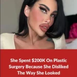 An addict to plastic surgery spends $200K on the procedure.