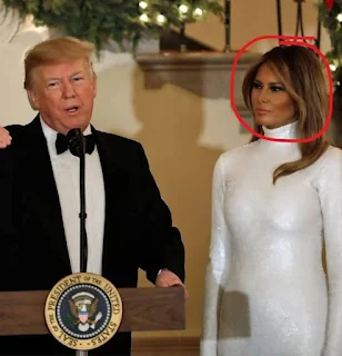 Melania Trump’s visit to Mar-a-Lago stokes rumors of plastic surgery