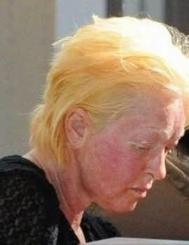 Cyndi Lauper deals with illness that causes severe pain