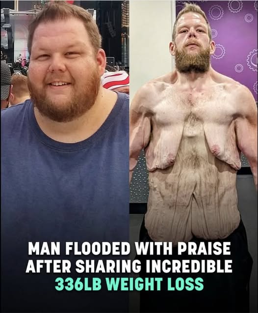 Internet praises man for 360lb weight loss