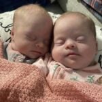 Mom of Twins with Down Syndrome Silences Critics