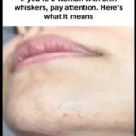 The Science Behind Chin Hair Growth