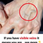 Are Blue Veins on Your Hands Normal—Or a Warning Sign of Something More Serious?