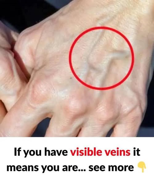 Are Blue Veins on Your Hands Normal—Or a Warning Sign of Something More Serious?