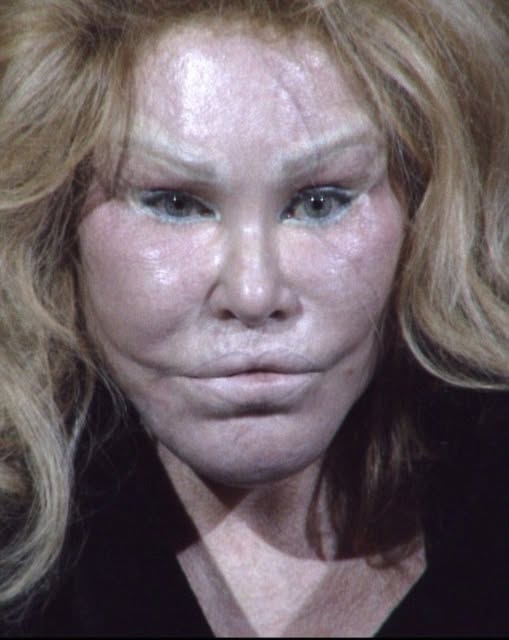Jocelyne Wildenstein Denies Plastic Surgery and Fillers