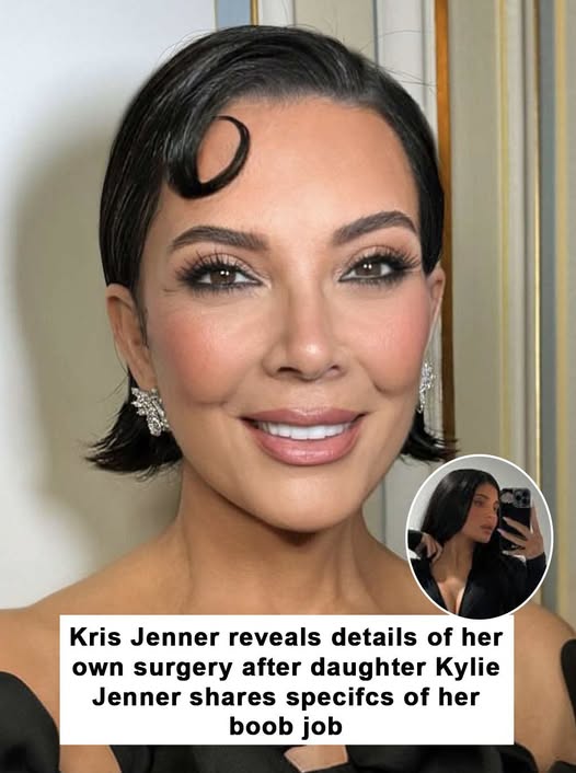Kris Jenner spills surgery secrets after Kylie’s big reveal