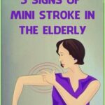 Mini Str0ke in the Elderly: Common and Unusual Symptoms