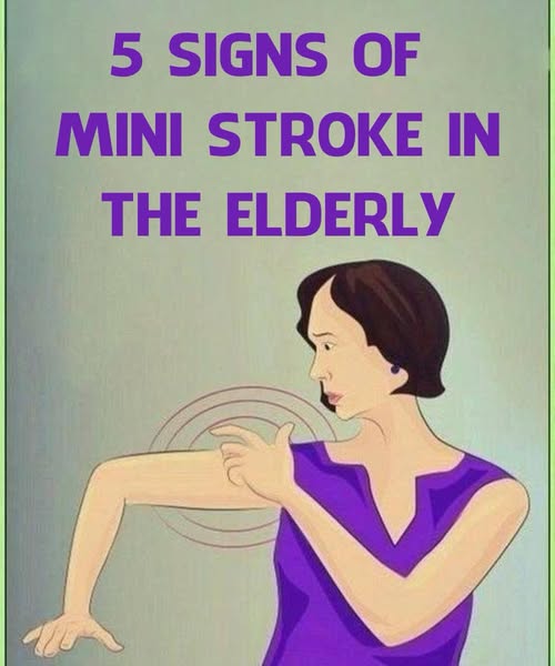 Mini Str0ke in the Elderly: Common and Unusual Symptoms
