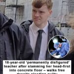 Teen who disfigures teacher avoids jail