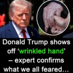 Trump shows off ‘wrinkled hands’ amid latest health fear