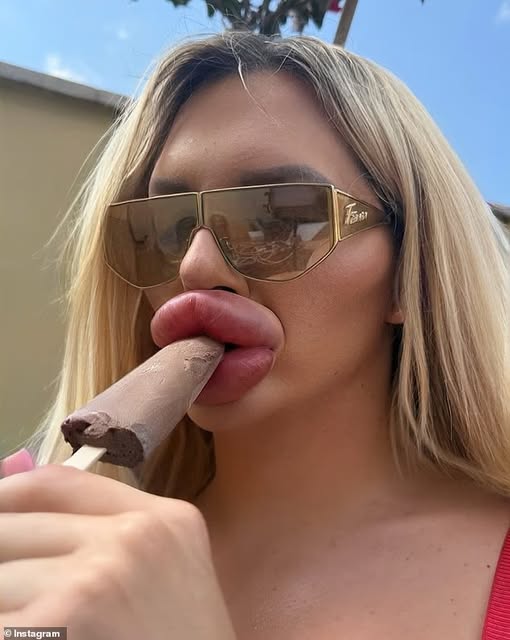 I’ve had so much lip filler I have trouble breathing and can’t close my mouth… but I have no plans to stop