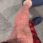 These are the consequences of sleeping with…See more