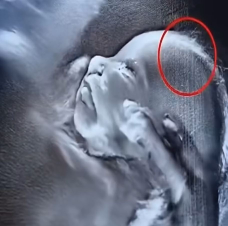 What Doctors Spotted on the Ultrasound Left Them Speechless