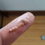 White bits in the egg: what are they really and should you be worried?