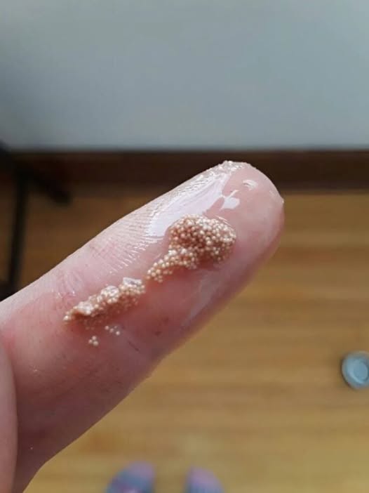 White bits in the egg: what are they really and should you be worried?