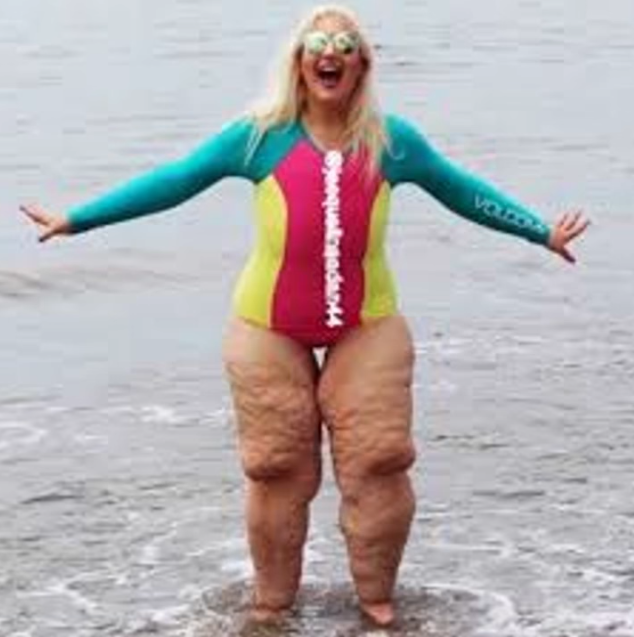 Woman has smart response to bullies mocking “disgusting” legs