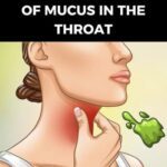 Real Causes of Mucus in the Throat