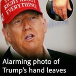 Alarming photo of Trump’s hand sparks deep concern