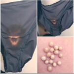 BE CAREFUL, if you notice this in your underwear, it means you have Ca…see more