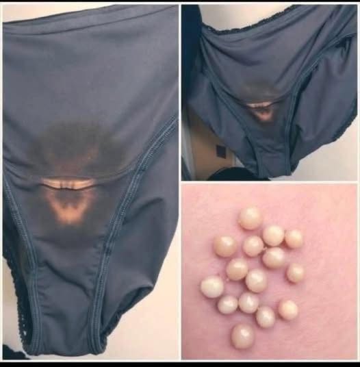 BE CAREFUL, if you notice this in your underwear, it means you have Ca…see more
