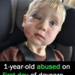 Daycare worker arrested after toddler arrives with black eye and swollen face on first day