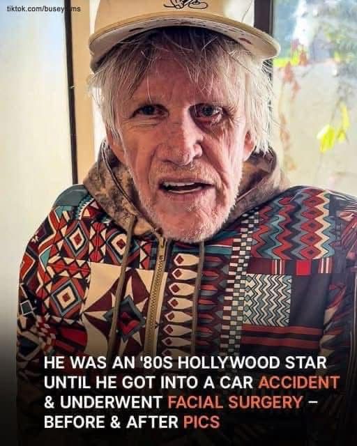 He Was A Hollywood Star In The ’80s, But Then Survived A Terrible Road Accident & Underwent Facial Surgery – His Pics At 80