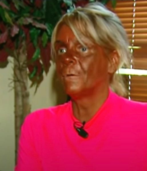 How Patricia Krentcil, “Tan Mom”, looks like today