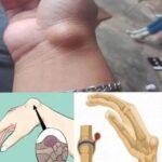 If You Get These Bruises on Your Body, It Might Mean Something Serious