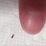 If you find this bug in your hair. How to get rid of them and stop them coming back