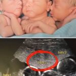 Mother Rushes To Emergency Room To Deliver Triplets: Then Nurses Look Closer At Their Faces And
