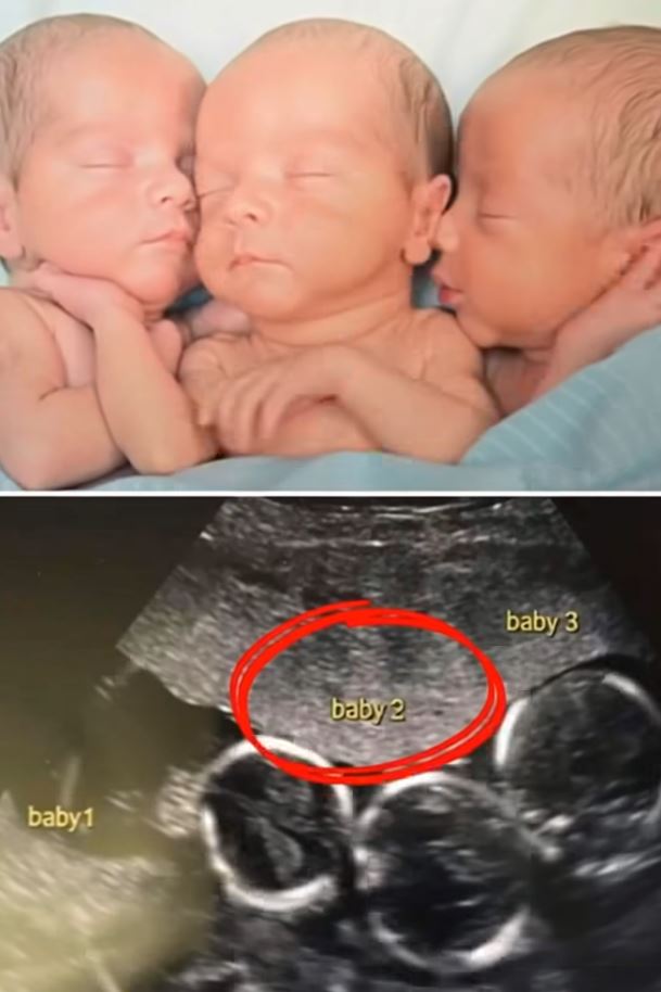 Mother Rushes To Emergency Room To Deliver Triplets: Then Nurses Look Closer At Their Faces And