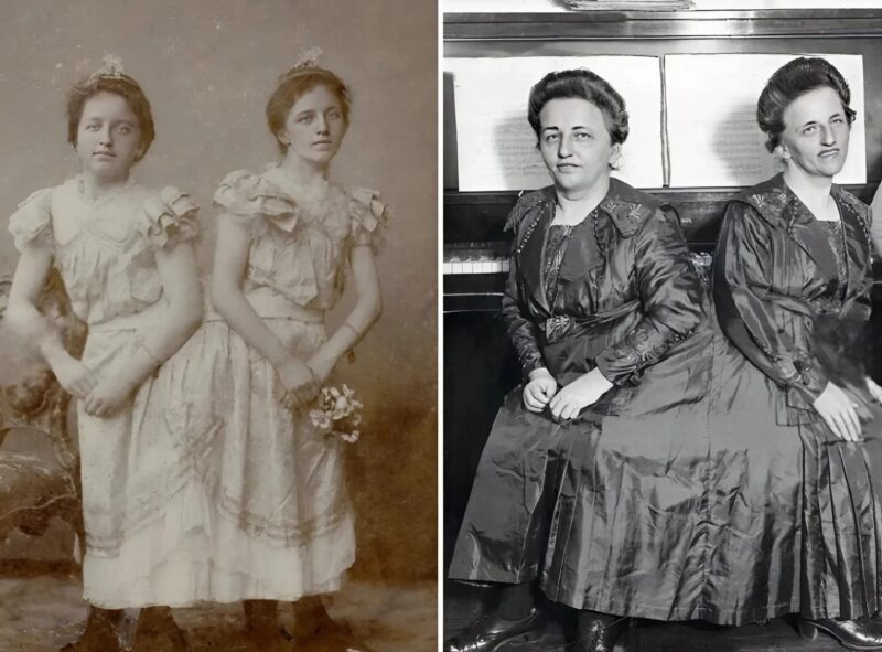 One of the Siamese twin sisters became pregnant and gave birth to a son: this is what their child looks like