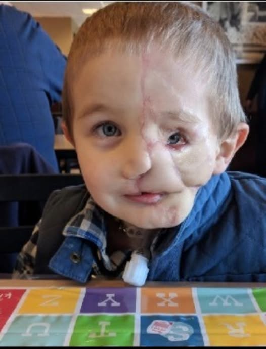 Ryder, 5, survives attack by two dogs only to be called a monster in public