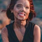 She Was Supposed to Die as a Baby—Today She Inspires the World.