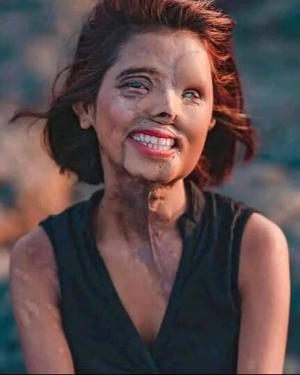 She Was Supposed to Die as a Baby—Today She Inspires the World.