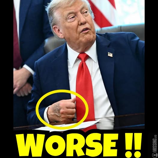 TRUMP DIAGNOSED WITH LEG CONDITION — HEALTH UPDATE REVEALED