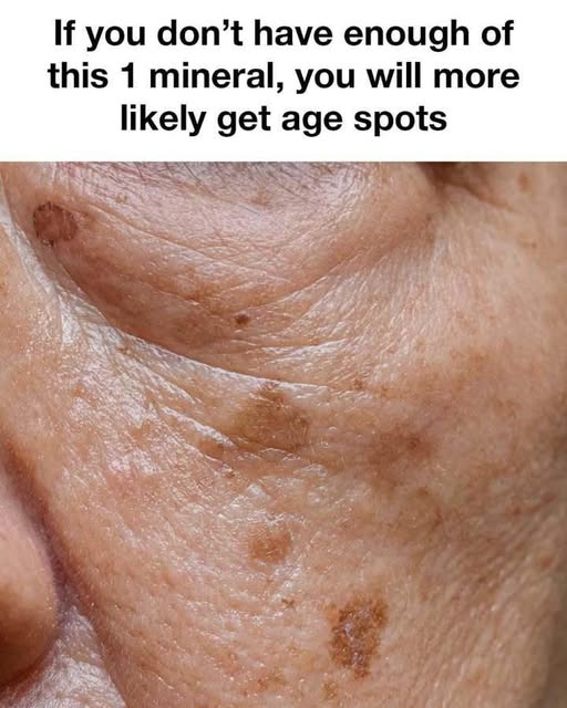 The Surprising Mineral That Helps Fight Age Spots Naturally After 60