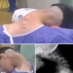 Young man hospitalized because he dropped his ca… See more