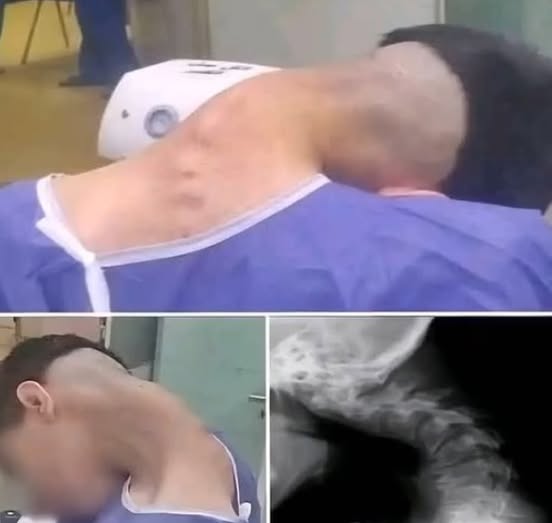 Young man hospitalized because he dropped his ca… See more