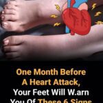 6 Foot Signals That Hint at Heart Trouble Early
