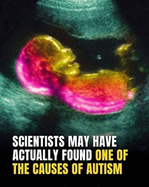 Could a Mother’s Gut Bacteria Influence Autism Risk? New Study Explores the Link