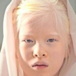 Girl abandoned at birth for her looks wants to prove the world wrong – she now models for Vogue.