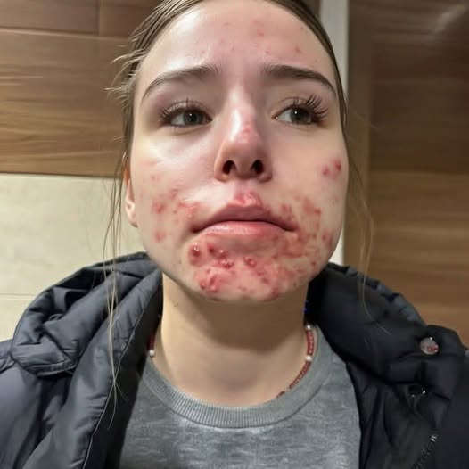 These are the consequences of sleeping with…See more