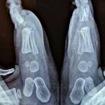 Why Babies Shouldn’t Wear Shoes Too Early: A Guide to Foot Development