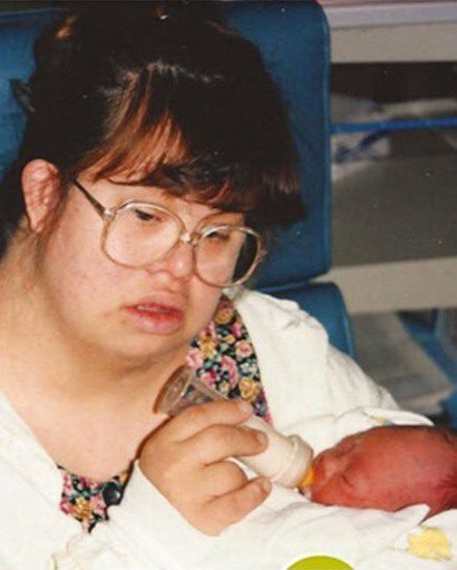 Couple with Down syndrome decide to have children, face criticism.