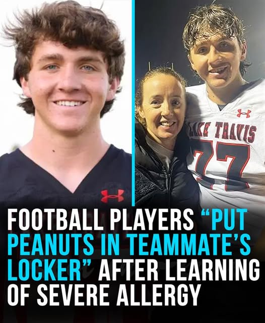 Football players “deliberately put peanuts in severely allergic teammate’s locker”
