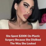 Plastic surgery addict spends $200K on plastic surgery.