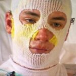 Uncle left with third-degree burn!