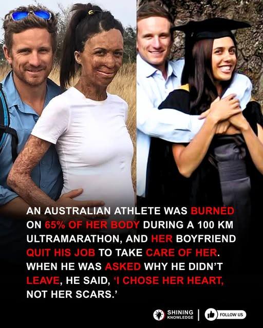 “Turia Pitt: A Story of Unbreakable Will and the Power of Love”